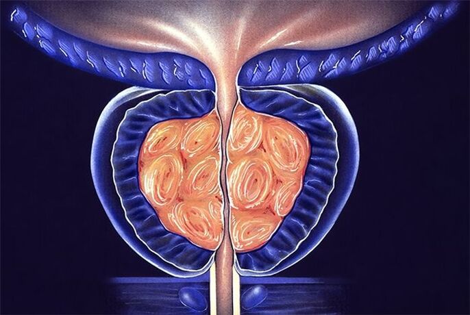 Symptome und Behandlung von Prostatitis